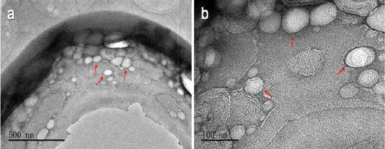 柠檬醛脂质体在不同放大倍数下的透射电子显微镜图像