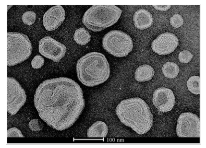脂质体透射电镜（TEM）检测结果(x100000)