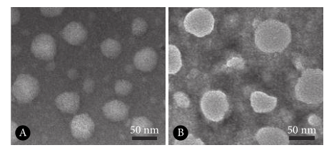 NE-OVA(A)和CS-NE-OVA(B)的透射电镜图 NE-OVA(A)和CS-NE-OVA(B)的透射电镜图